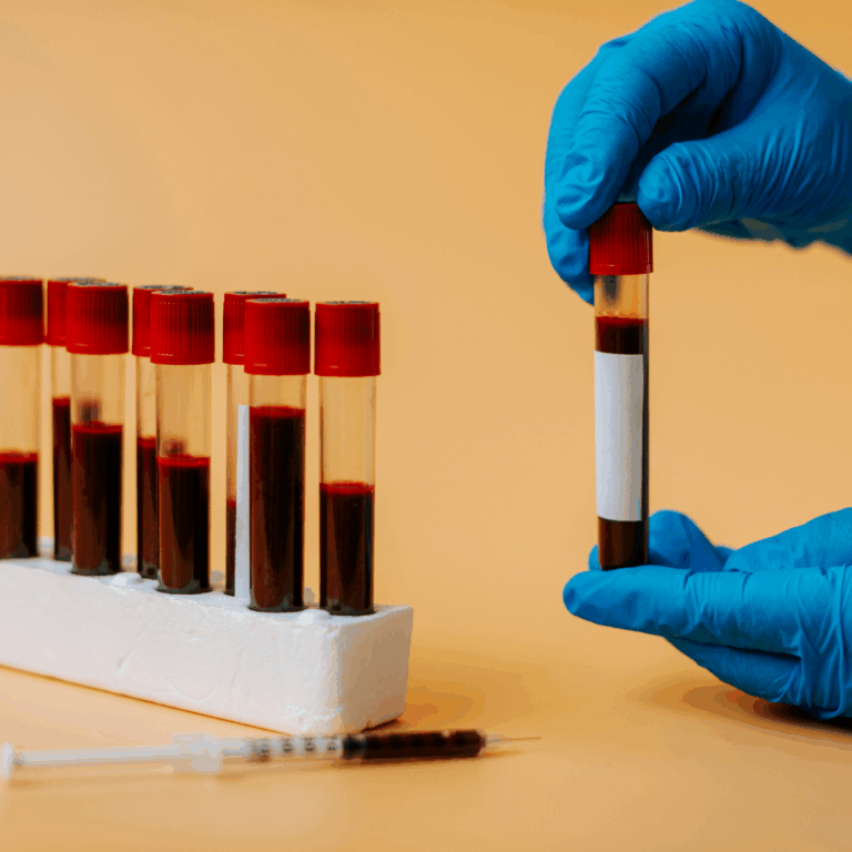 Hands with blue gloves holding a vial of blood for biomarker testing. Five more vials sitting upright on the table.