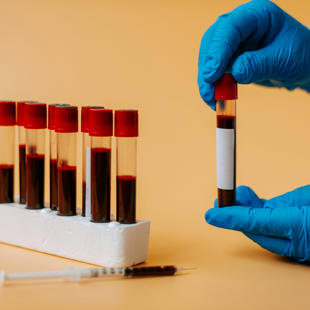 Hands with blue gloves holding a vial of blood for biomarker testing. Five more vials sitting upright on the table.